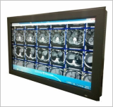 Medical Grade LCD Monitor 55 Inch Color