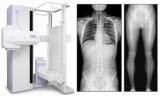 CE Approved DR X-Ray System / DDR Inventor-V for Chest