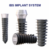 IBS implant system