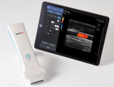 SONON 300L Ultrasound Imaging System for VET