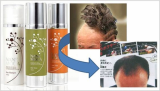 Nanemoga Shampoo (Prevention Hair-loss) 150ml