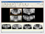 PointNix CDX View Digital X-ray Intergation Management 