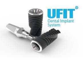 Ufit dental implant system