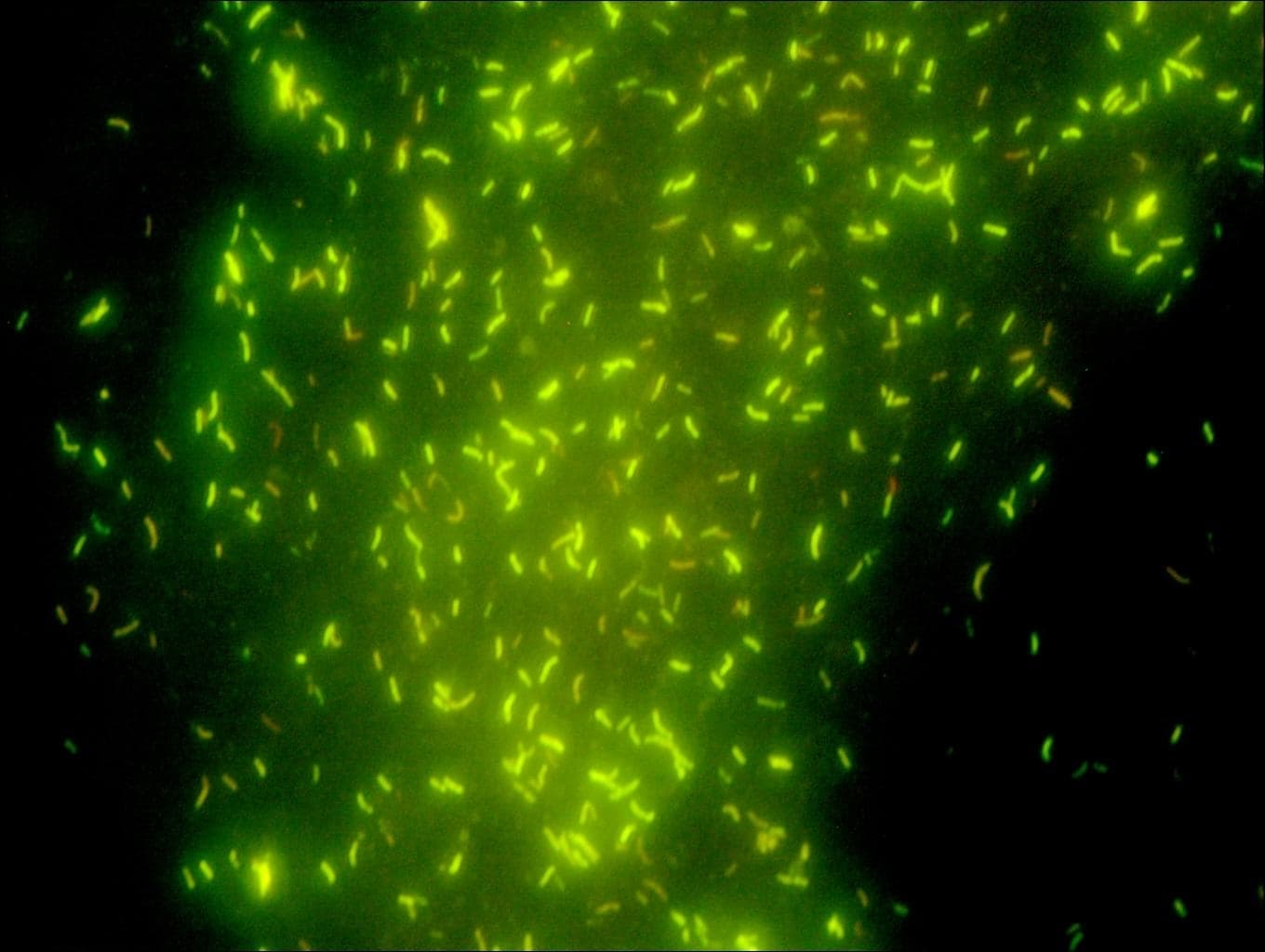 Называют обладают флюоресцируют. Микобактерии туберкулеза люминесцентная микроскопия. Микобактерии люминесцентная микроскопия. Люминесцентная микроскопия МБТ. Флуоресцентная микроскопия микобактерии.
