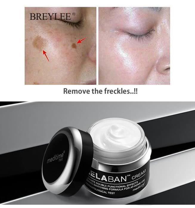 MELABAN Cream for the Freckles _ Dark Age Spots 50g