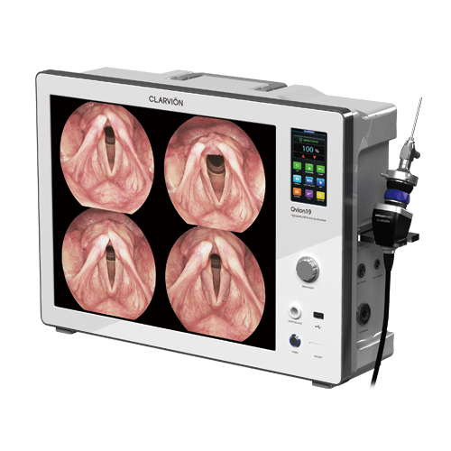 Portable_ Endoscopic visual system_QVION