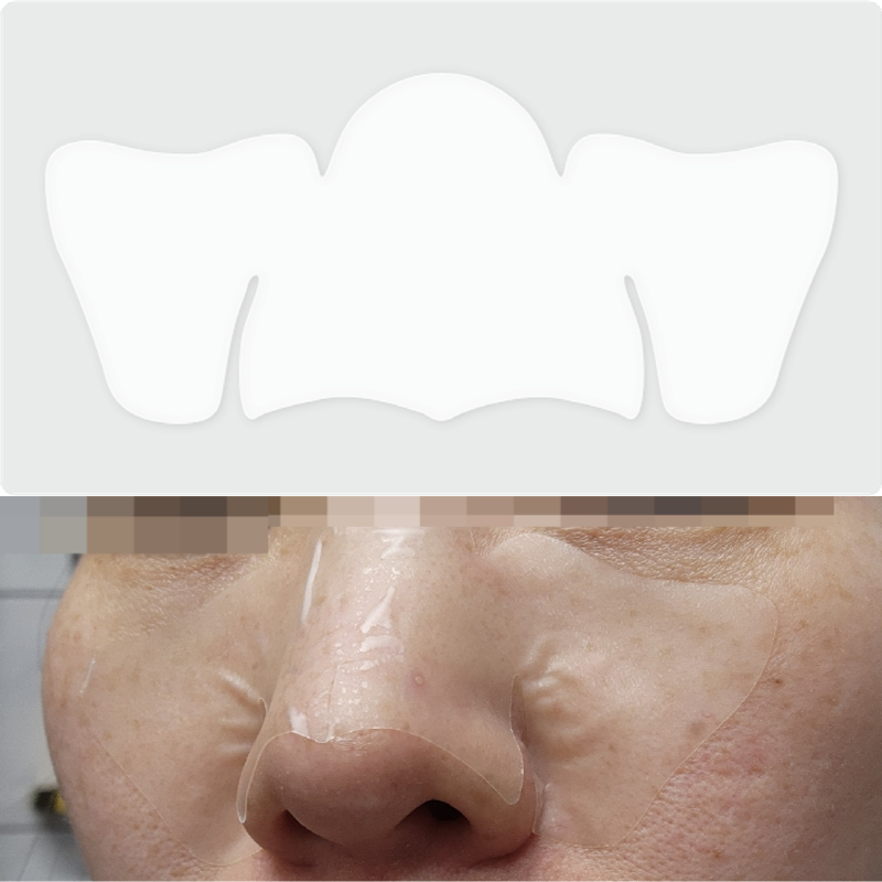 Hydrocolloid Nose Patch _OEM_