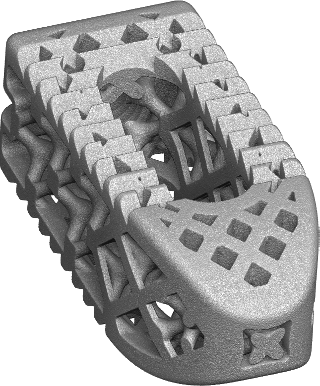 GENOSS Lumbar 3d Cage