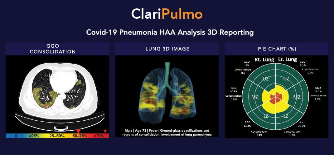 ClariPulmo_Fully Automated AI Powered 3D Reporting Solution for COVID19
