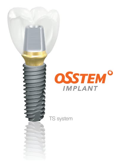 Dental Implant Fixture_TSIII SA Fixture