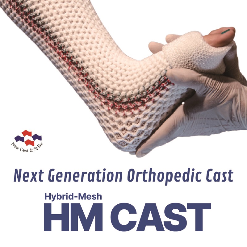 HM CAST _Next Generation Orthopedic Cast_
