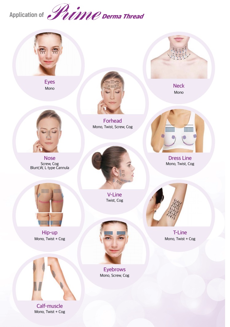 PDO THREADS_SUTURES_