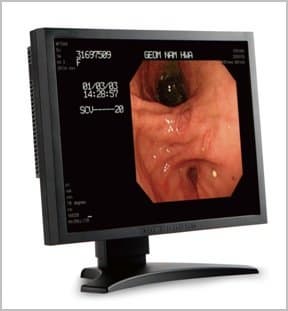 Medical Grade LCD Monitor 20.1inch 2MP Color