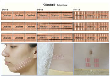 Acupuncture product(Medical patch, medical bandage )