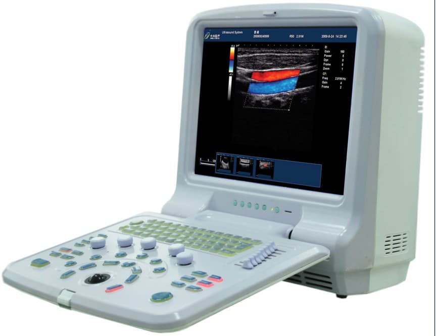 Color Ultrasound Scanner MS3000