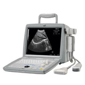 Portable Ultrasound Scanner OSEN800B